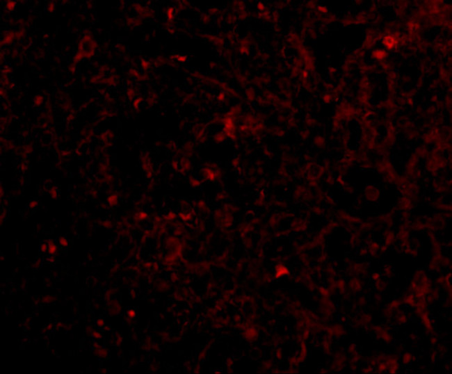 STEAP1 Antibody in Immunohistochemistry (IHC)