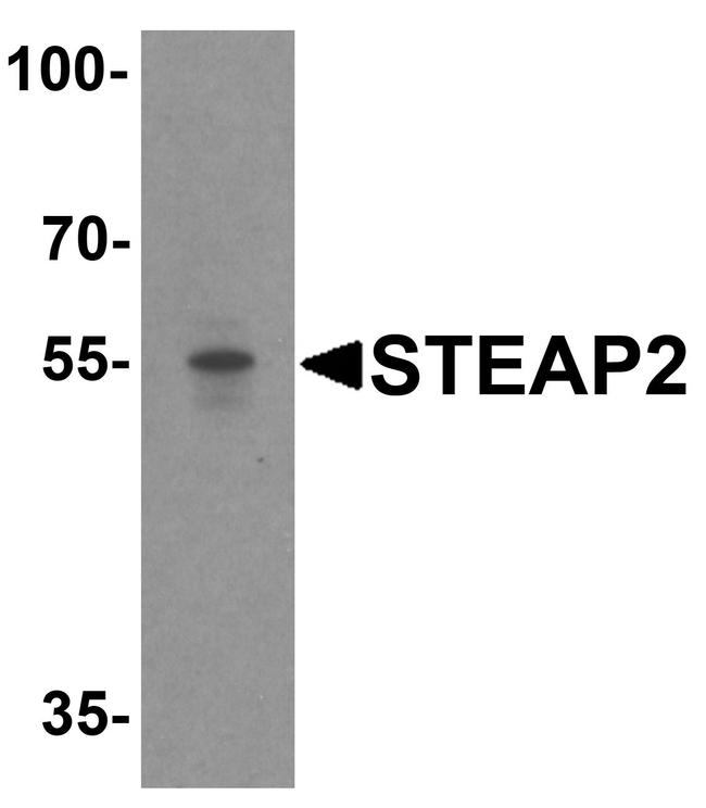 STEAP2 Antibody in Western Blot (WB)