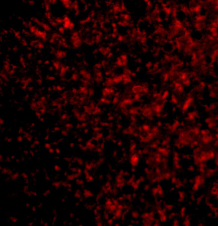 STEAP3 Antibody in Immunocytochemistry (ICC/IF)