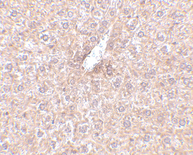 STEAP3 Antibody in Immunohistochemistry (IHC)