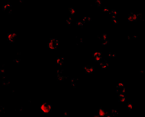 TDP-43 Antibody in Immunocytochemistry (ICC/IF)