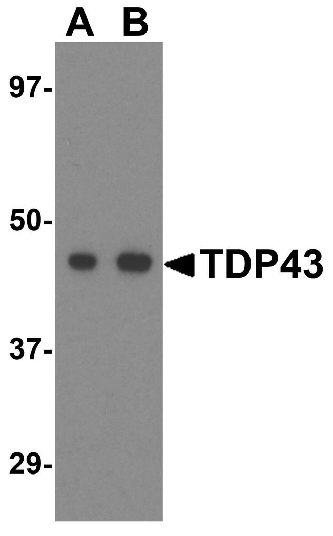 TDP-43 Antibody in Western Blot (WB)