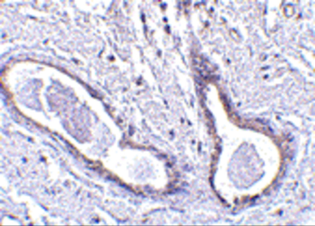 ABRA1 Antibody in Immunohistochemistry (IHC)