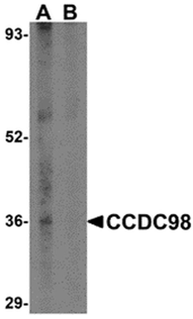 ABRA1 Antibody in Western Blot (WB)