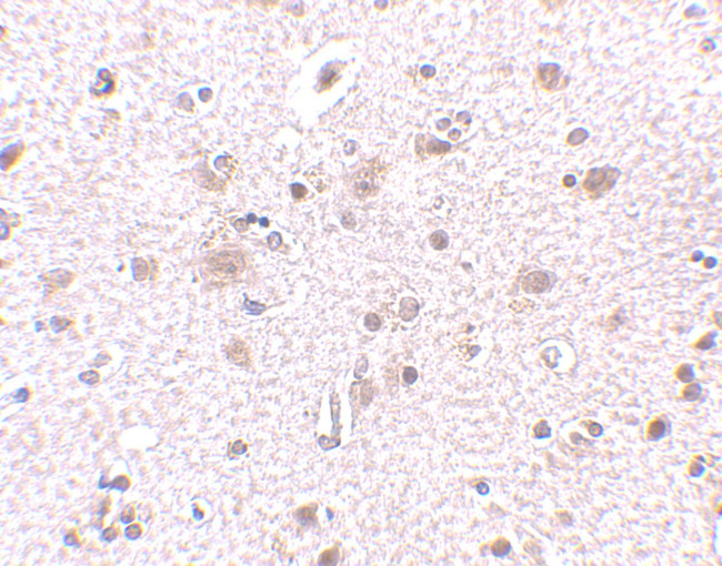 BRE Antibody in Immunohistochemistry (IHC)