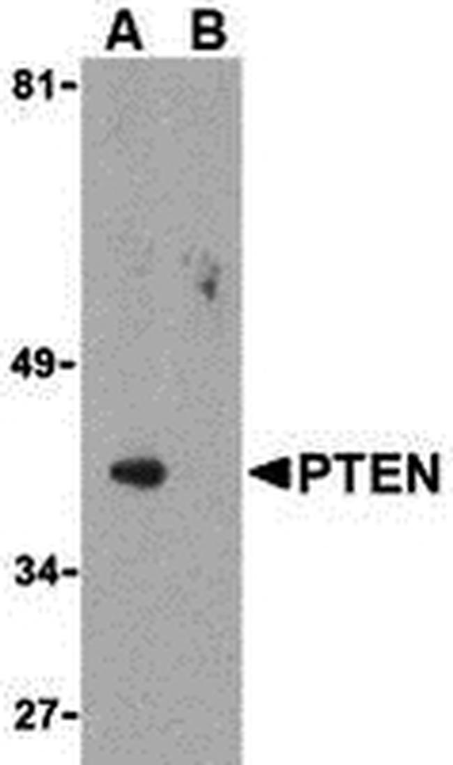 PTEN Antibody in Western Blot (WB)