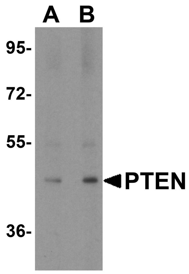 PTEN Antibody in Western Blot (WB)