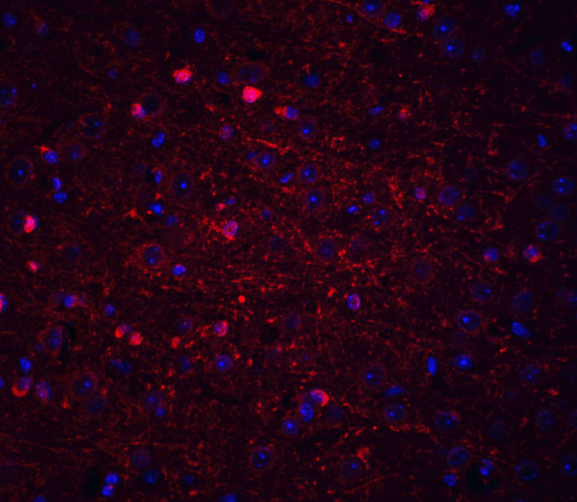 Kinesin 5A Antibody in Immunohistochemistry (IHC)