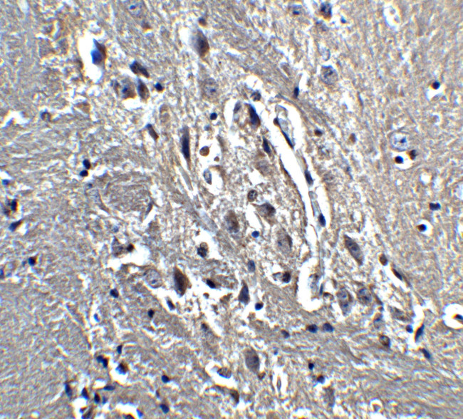 Kinesin 5A Antibody in Immunohistochemistry (IHC)