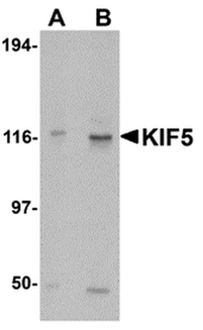 Kinesin 5A Antibody in Western Blot (WB)