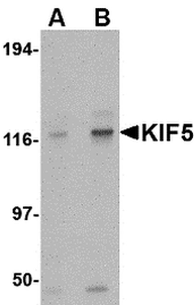 Kinesin 5A Antibody in Western Blot (WB)