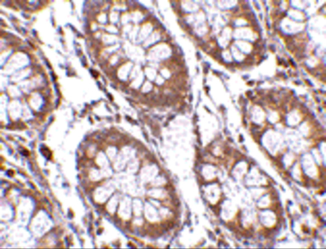 PTK7 Antibody in Immunohistochemistry (IHC)