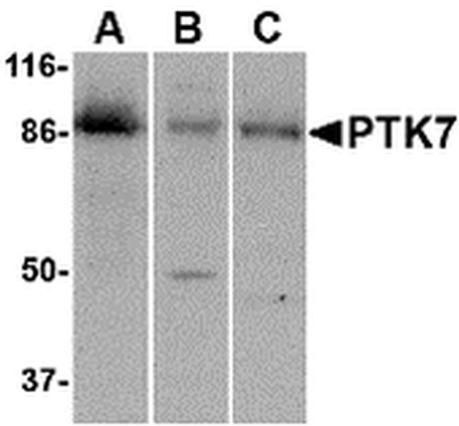 PTK7 Antibody in Western Blot (WB)