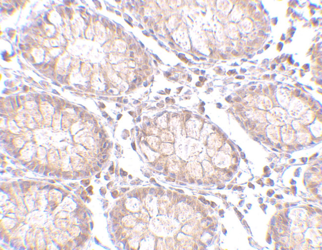 PTK7 Antibody in Immunohistochemistry (IHC)