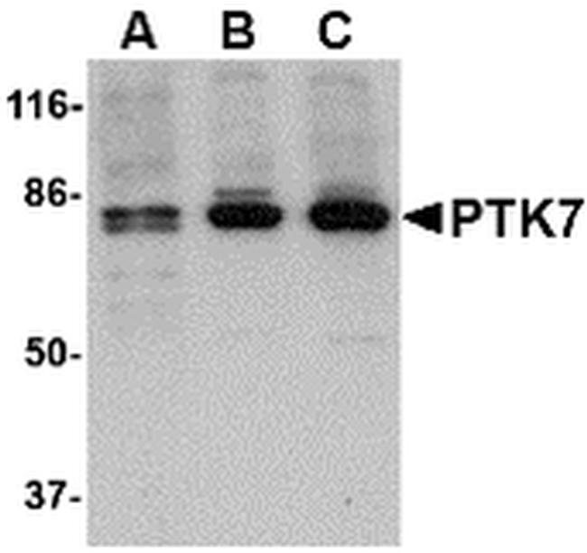 PTK7 Antibody in Western Blot (WB)