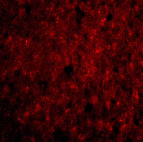 CDNF Antibody in Immunocytochemistry (ICC/IF)