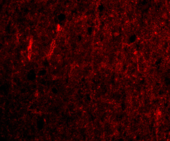 CDNF Antibody in Immunocytochemistry (ICC/IF)