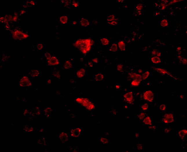 ARMET Antibody in Immunocytochemistry (ICC/IF)