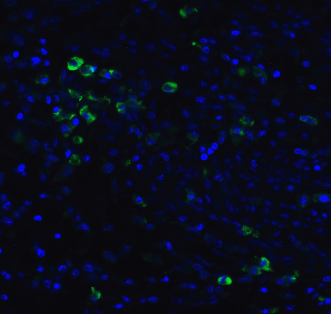 ARMET Antibody in Immunocytochemistry (ICC/IF)