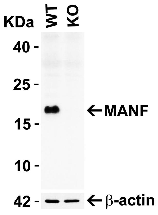 ARMET Antibody in Western Blot (WB)