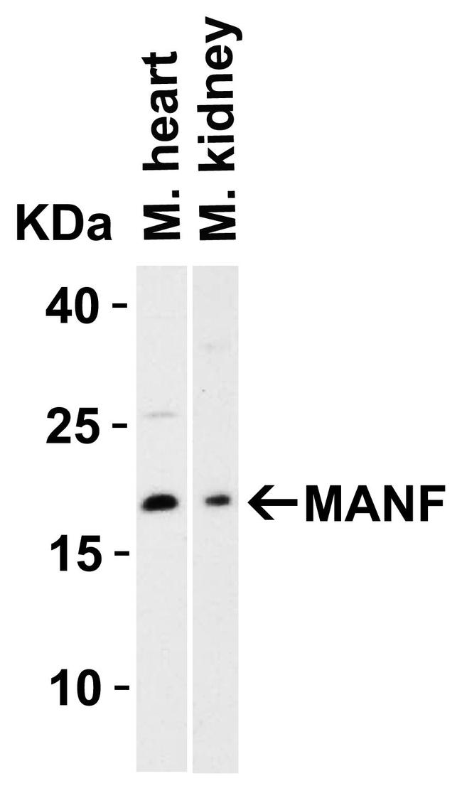 ARMET Antibody in Western Blot (WB)