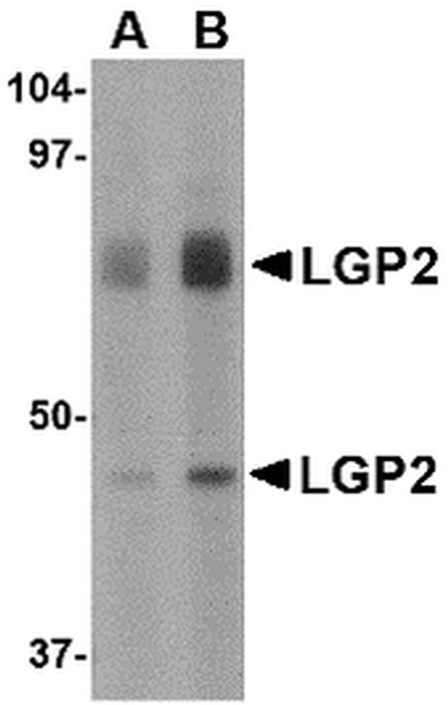 LGP2 Antibody in Western Blot (WB)