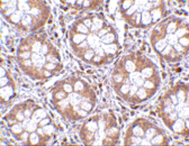 RASD2 Antibody in Immunohistochemistry (IHC)