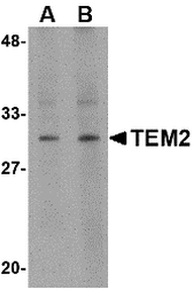 RASD2 Antibody in Western Blot (WB)