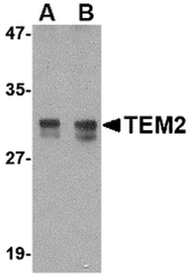 RASD2 Antibody in Western Blot (WB)