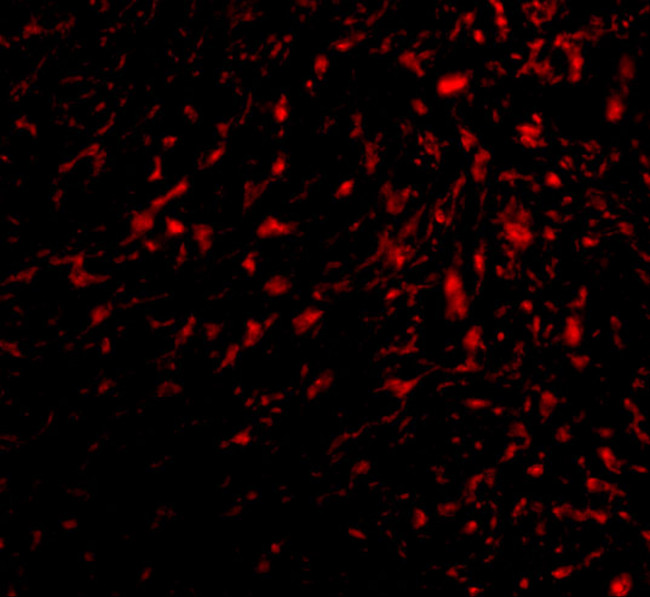 TEM5 Antibody in Immunohistochemistry (IHC)