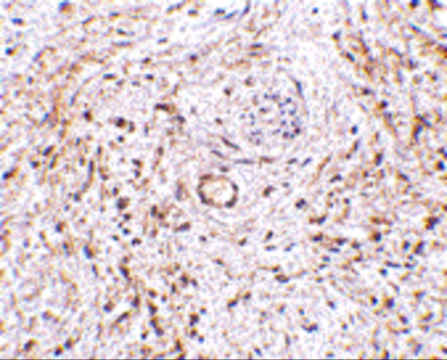 TEM5 Antibody in Immunohistochemistry (IHC)