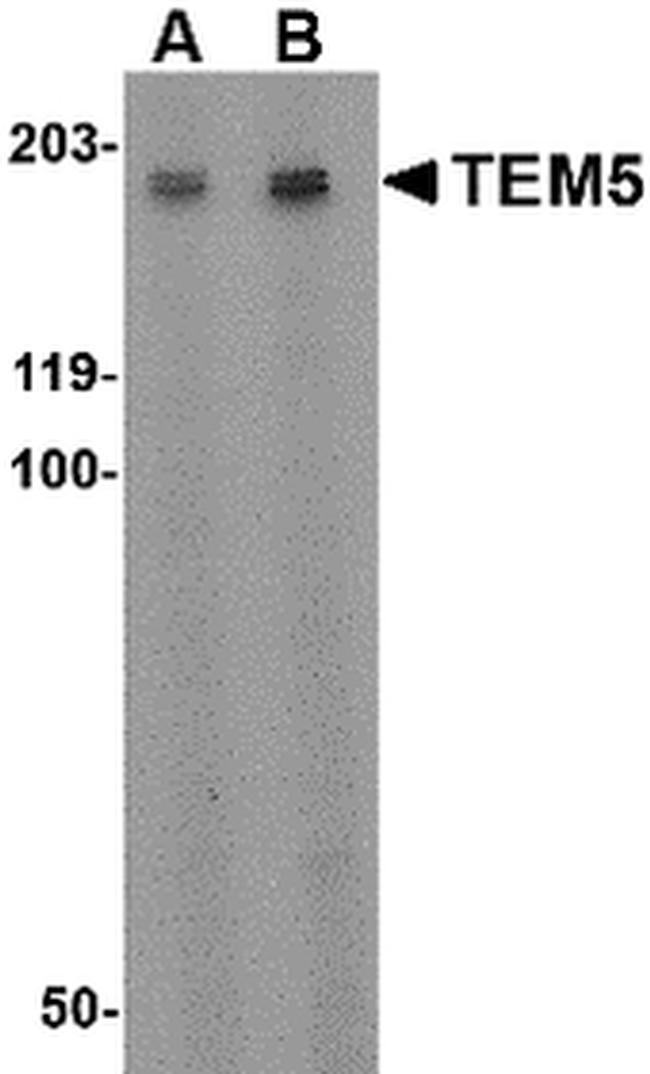 TEM5 Antibody in Western Blot (WB)