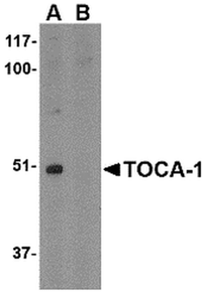 TOCA-1 Antibody in Western Blot (WB)