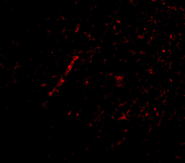 Nhe-1 Antibody in Immunohistochemistry (IHC)