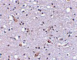 Nhe-1 Antibody in Immunohistochemistry (IHC)