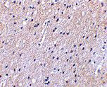 Nhe-1 Antibody in Immunohistochemistry (IHC)