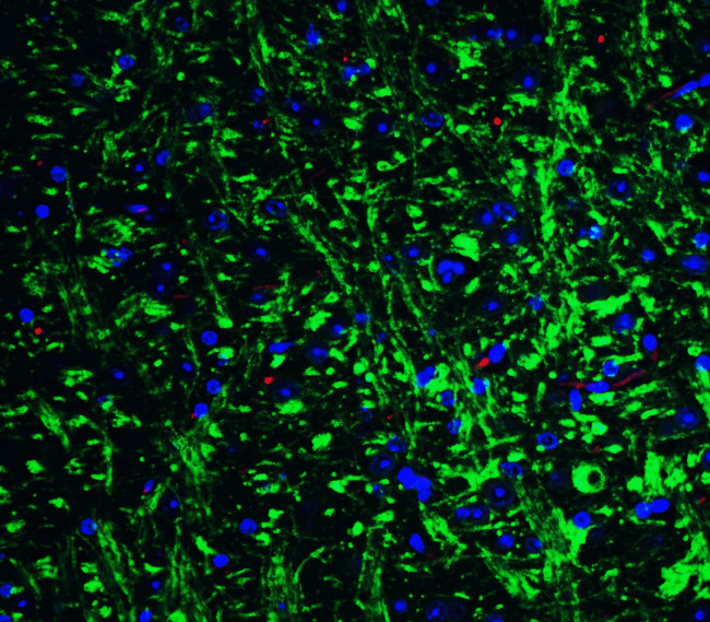 GRIK1 Antibody in Immunohistochemistry (IHC)