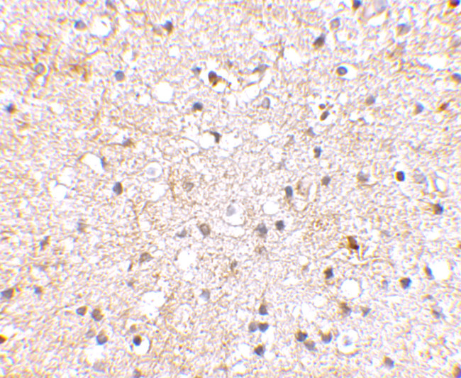 GRIK1 Antibody in Immunohistochemistry (IHC)