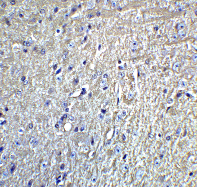 GRIK1 Antibody in Immunohistochemistry (IHC)