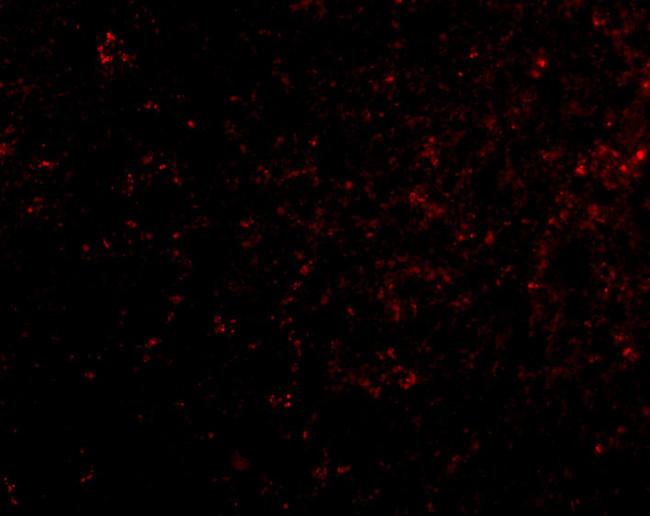 GRIK4 Antibody in Immunocytochemistry (ICC/IF)