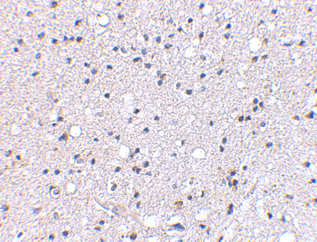 GRIK4 Antibody in Immunohistochemistry (IHC)