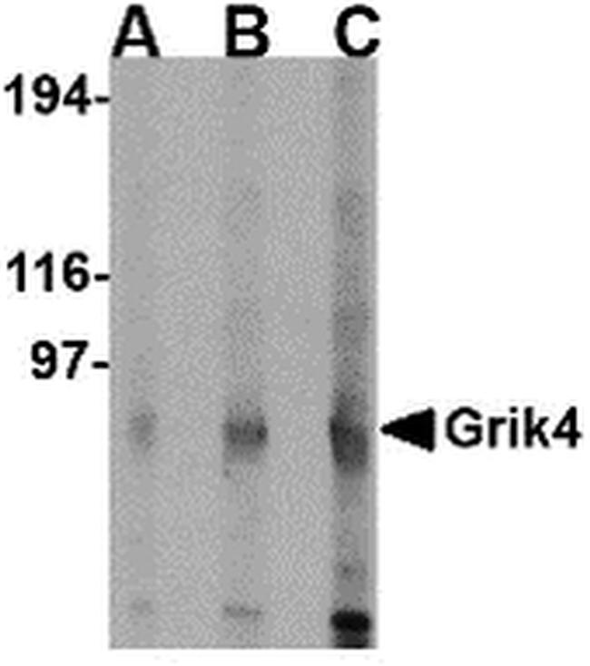 GRIK4 Antibody in Western Blot (WB)