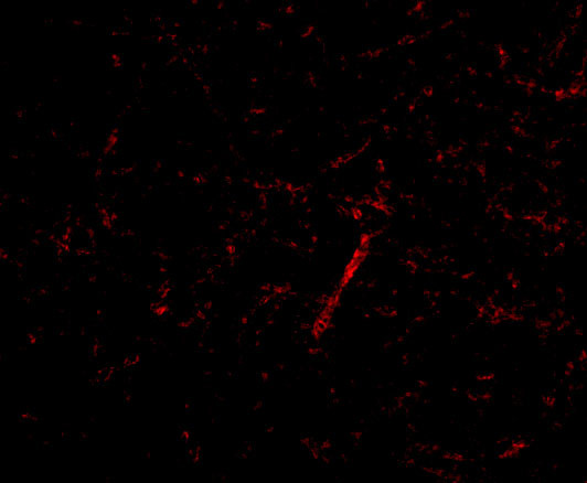 GRIK4 Antibody in Immunocytochemistry (ICC/IF)