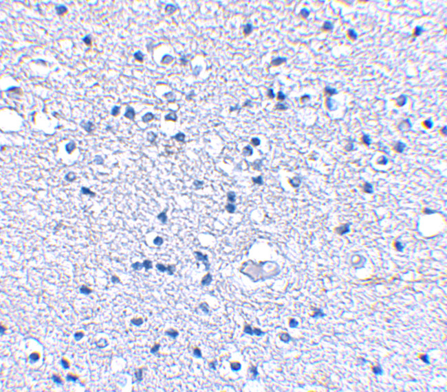 GRIK4 Antibody in Immunohistochemistry (IHC)