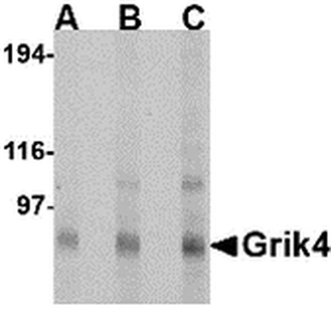 GRIK4 Antibody in Western Blot (WB)