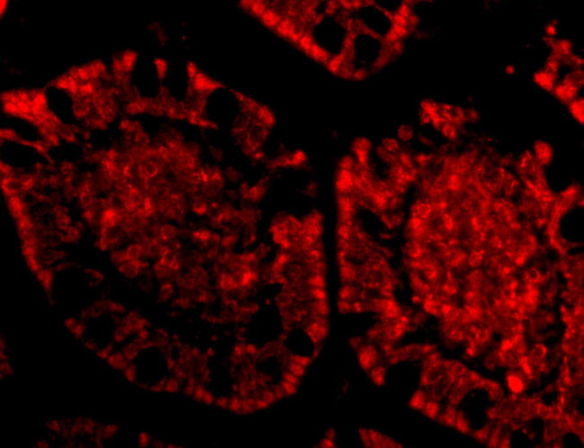 ZBP1 Antibody in Immunohistochemistry (IHC)