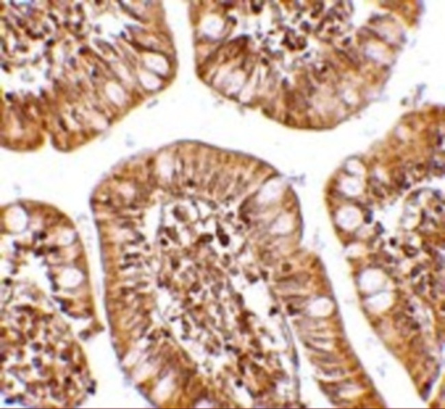 ZBP1 Antibody in Immunohistochemistry (IHC)