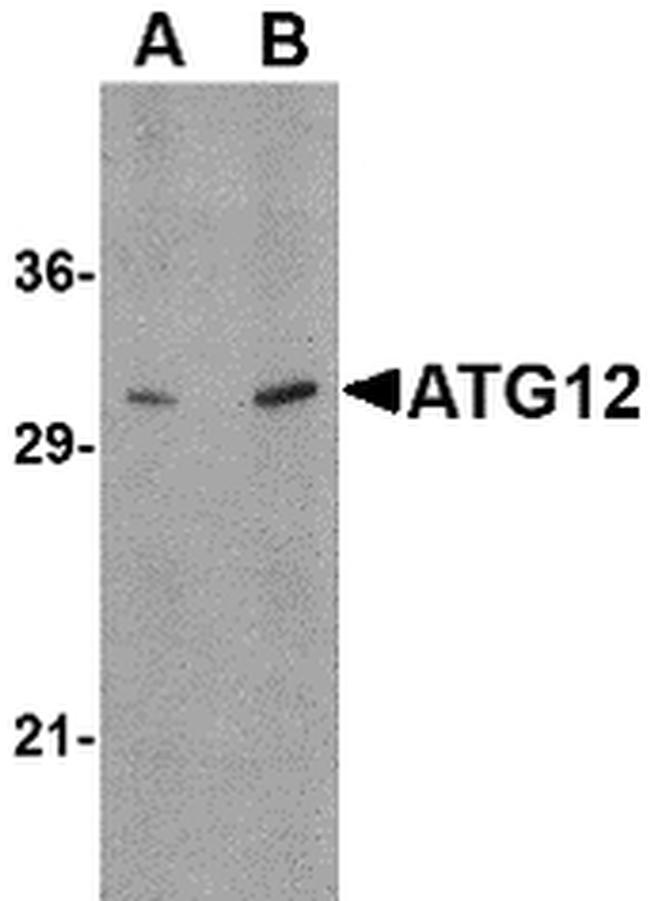 ATG12 Antibody in Western Blot (WB)