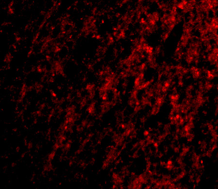 ATG12 Antibody in Immunocytochemistry (ICC/IF)