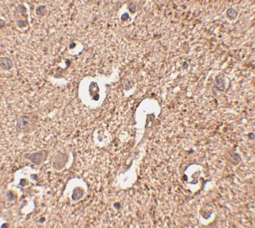 ATG12 Antibody in Immunohistochemistry (IHC)